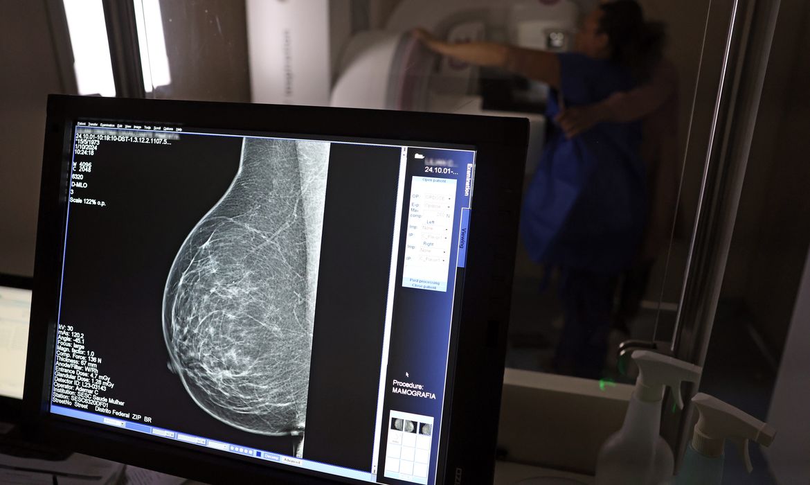 Ministério da Saúde passa a recomendar mamografia