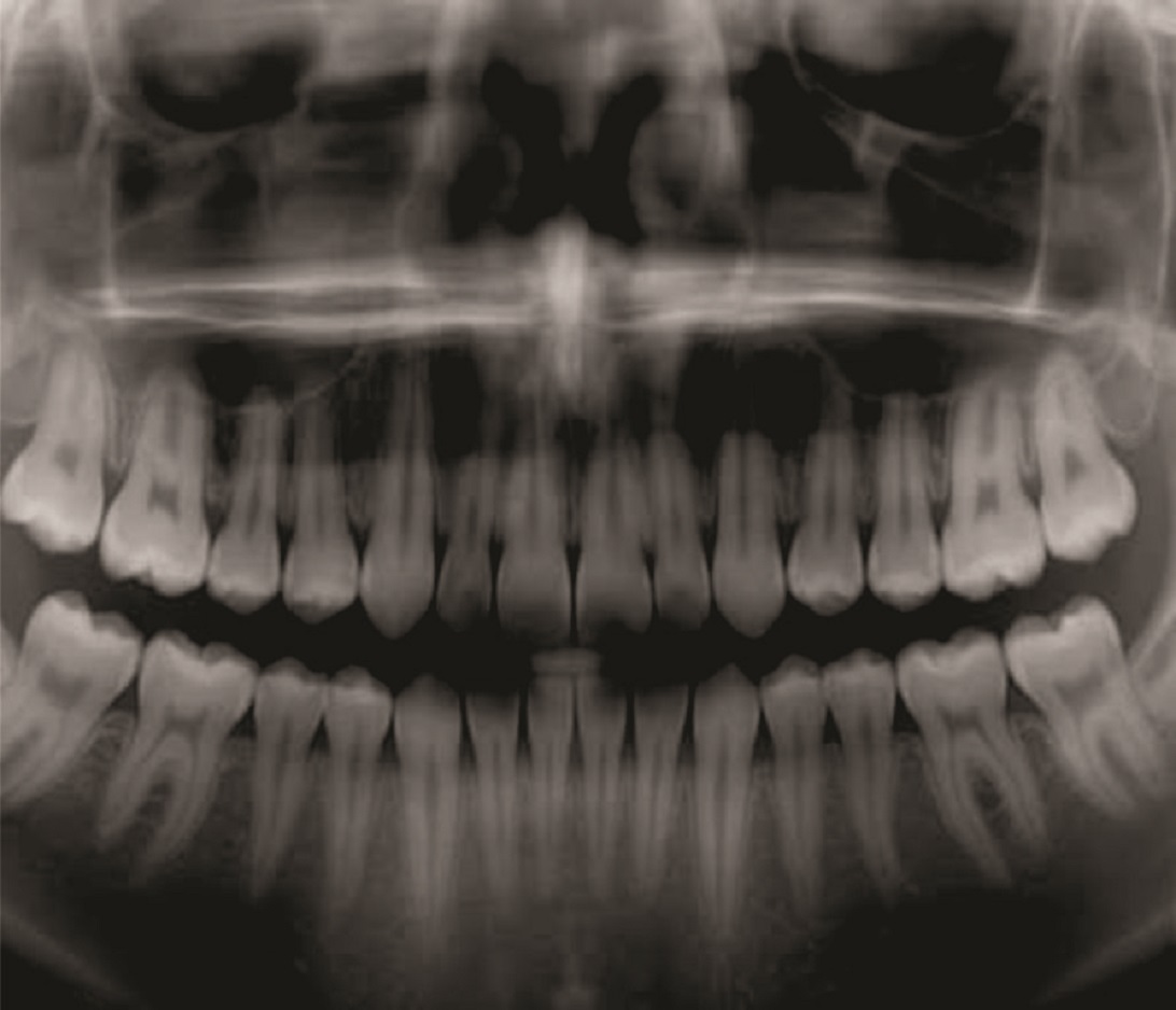 Japão desenvolve técnica para nova dentição